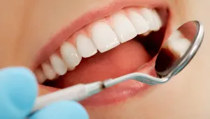 Dental Examination Chelmsford