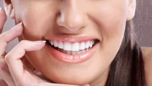 Smile Makeover Chelmsford